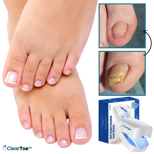 ClearToe™ מכשיר לייזר מתקדם לציפורניים | משמיד 99.9% מהפטרת תוך 4 ימים!