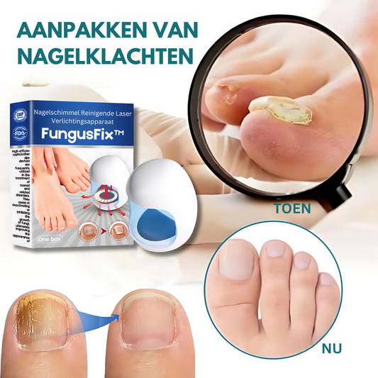 FungusFix™ Laser Nagelschimmel Verwijderaar