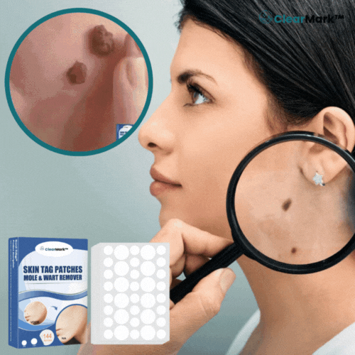 ClearMark™ מדבקות להסרת תגיות עור | מעלימות 98% מיבלות וכתמי לידה תוך 5 ימים בלבד!